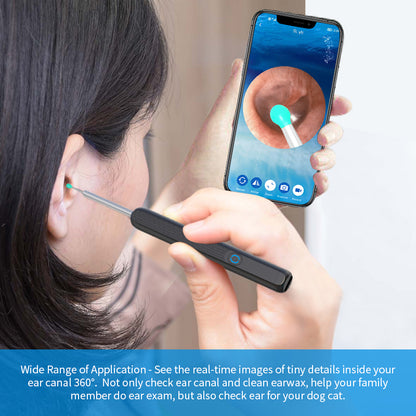 Smart Ear Wax Removal Otoscope with LED