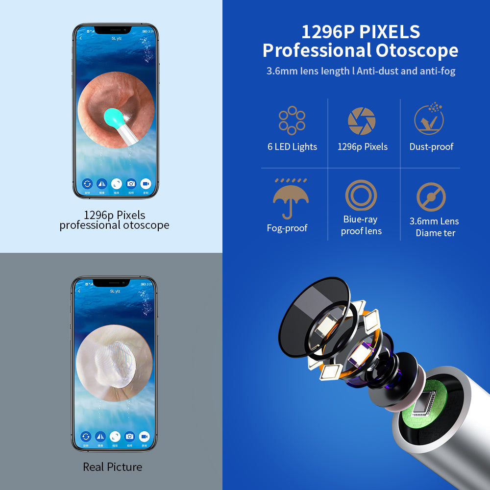 Smart Ear Wax Removal Otoscope with LED